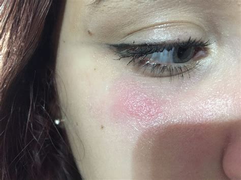 allergic to chanel makeup|allergic reaction to old makeup.